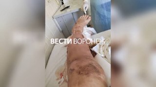 Тяжёлый несчастный случай на вагоноремонтном заводе в Лисках: ампутация ноги и штраф